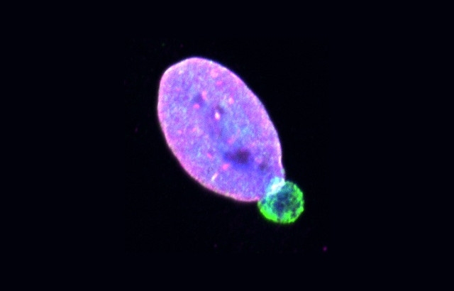 Representative images of a WM983B melanoma cell nucleus with a nuclear envelope bleb stained for Lamin A/C (green), Lamin B1 (magenta) and DNA (blue). Scale bar, 10 μm